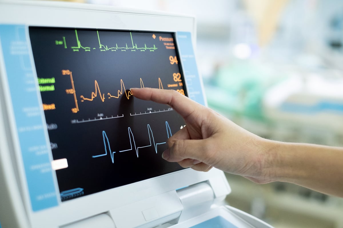 EKG monitor in intra aortic balloon pump machine — modern cardiology medical equipment