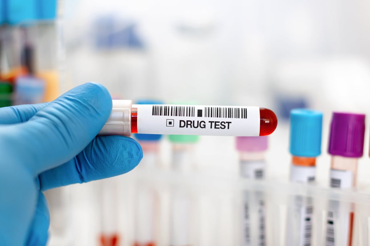 Doctor's hand with urinalysis and blood sample for drug test or alcohol in the laboratory