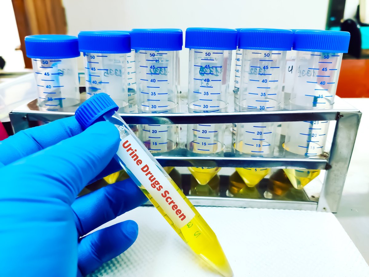 Laboratory sample of urine for drug test analysis