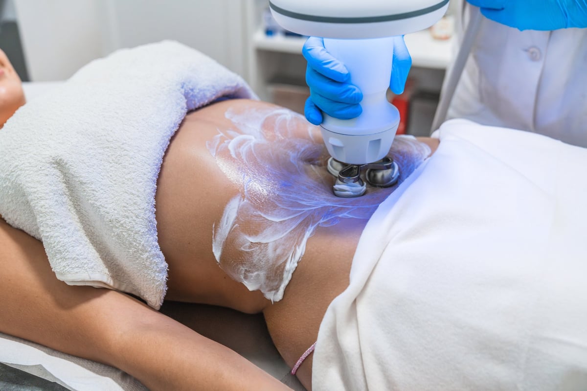 Beautician wearing blue gloves applying white gel on woman's belly for hardware body shaping in a beauty clinic