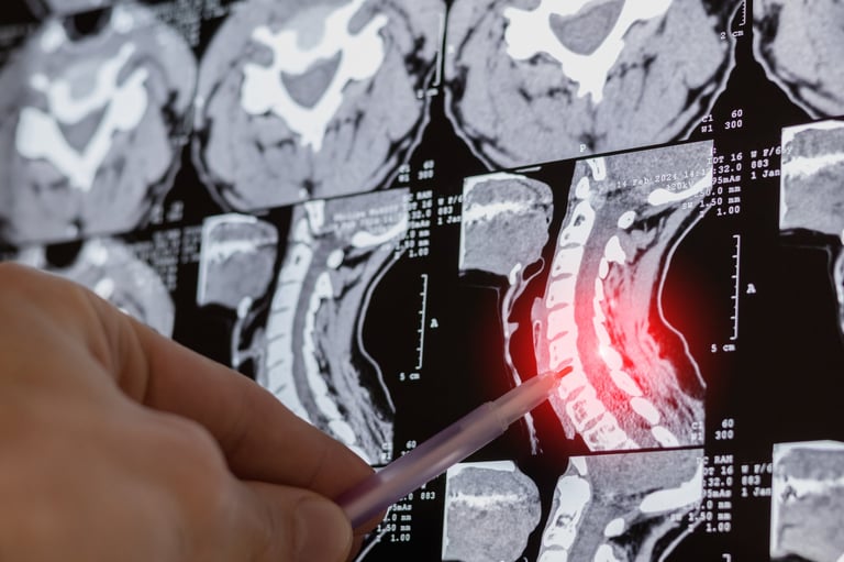 Close up of doctor reviewing digital X-ray of spine curvature