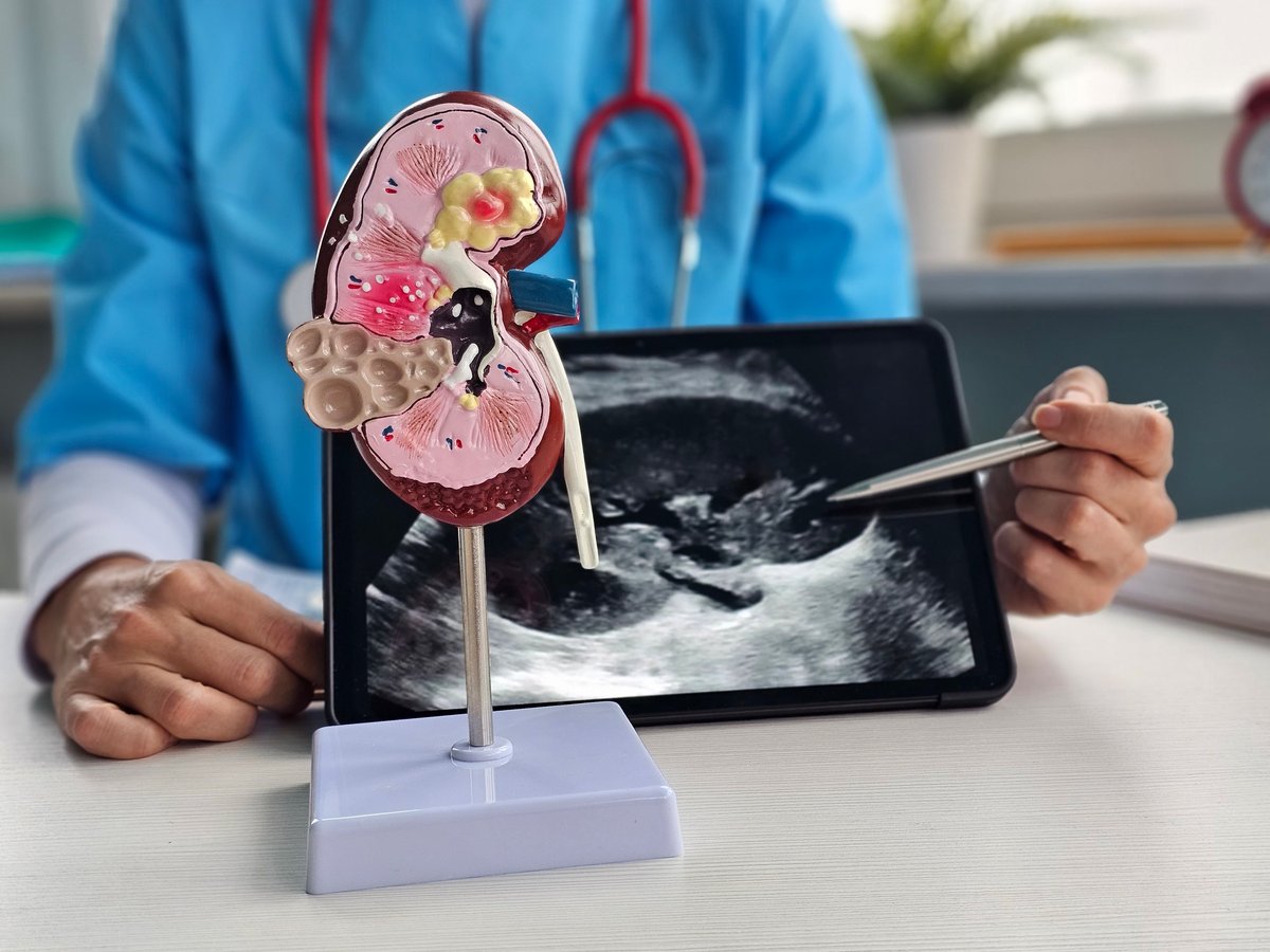 Especialista en nefrología explicando modelo anatómico renal durante sesión de formación clínica