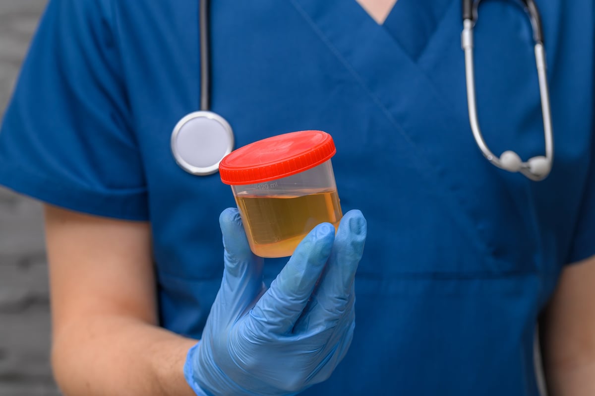 Doctor holding a plastic container with a patient's sample
