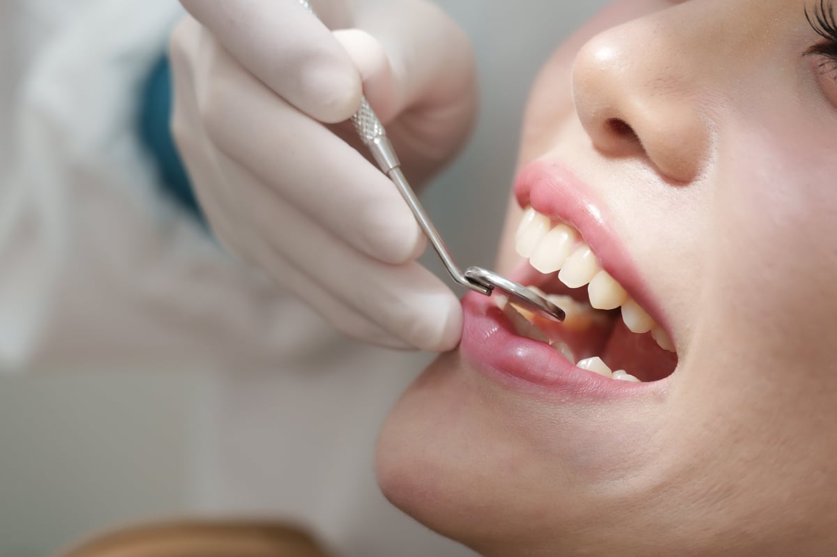 Dentist using a tool to carefully match resin to a patient's teeth during cosmetic bonding