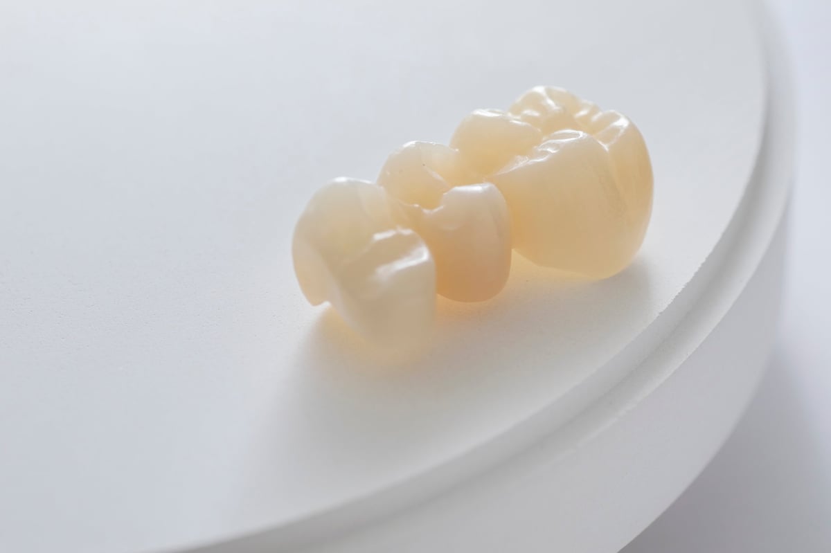 Natural-looking porcelain dental crown restorations