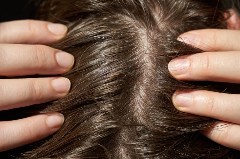 Close-up of brown hair and scalp with hands parting strands for a hair health inspection