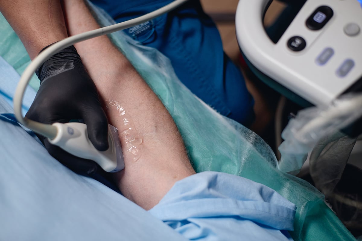 Paciente recibiendo examen de ultrasonido vascular Doppler en entorno clínico con equipo especializado