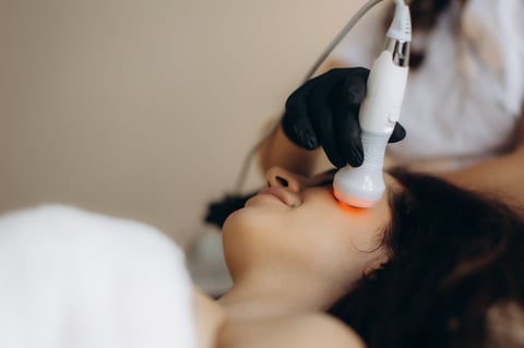 Tratamiento láser facial