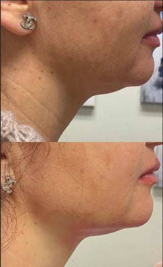 Before and after skin treatment