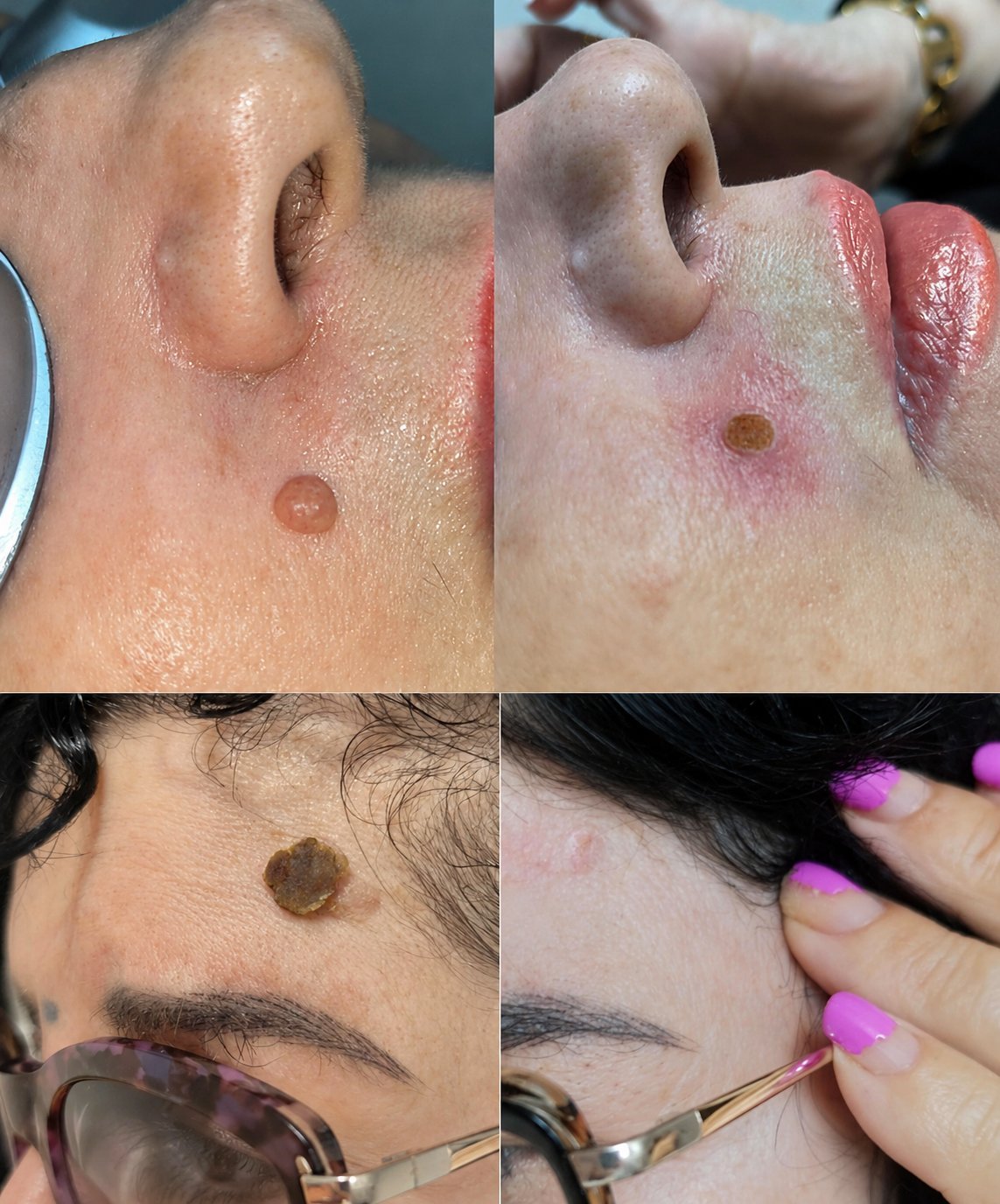 Antes y despues de tratamiento estetico