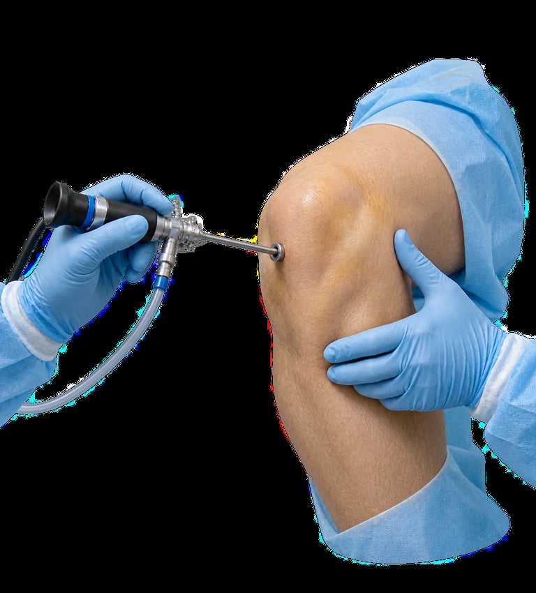 Artroscopia de rodilla realizada mediante una pequeña óptica