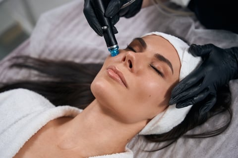 Woman receiving microneedling facial treatment with professional pen tool on forehead by aesthetician in black gloves